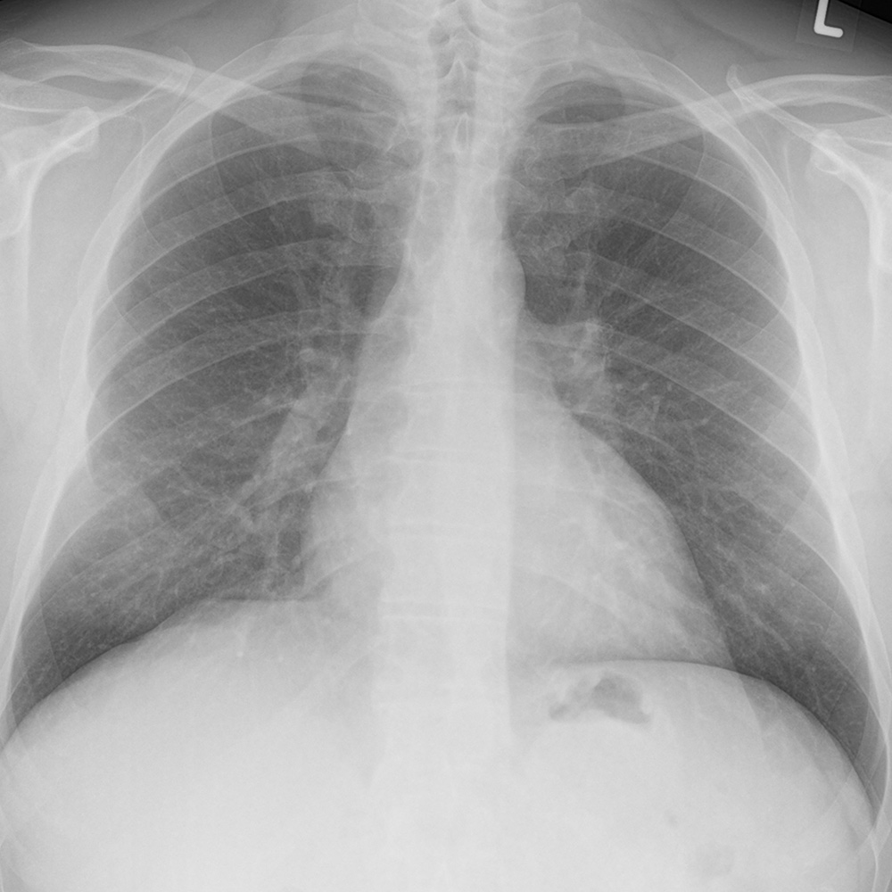 blog-dicom-beitrag-01